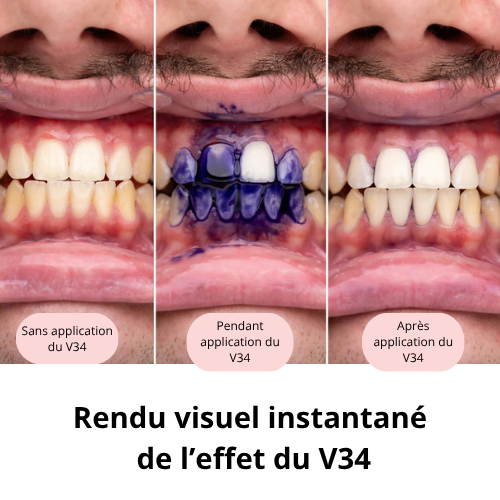 Sérum Correcteur de Couleur V34